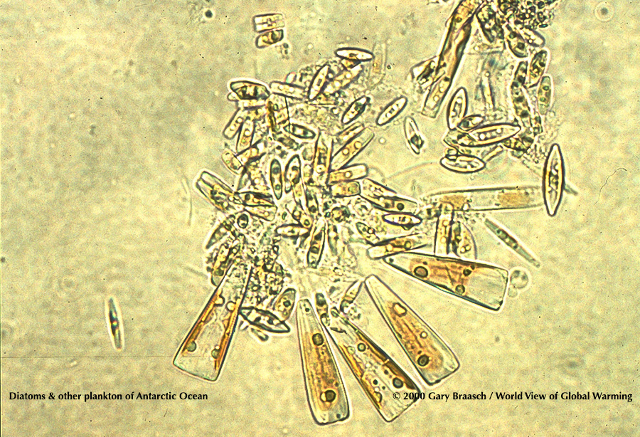 Photomicrograph of plankton 